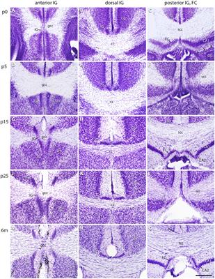 Postnatal Developmental Expression Profile Classifies the Indusium Griseum as a Distinct Subfield of the Hippocampal Formation